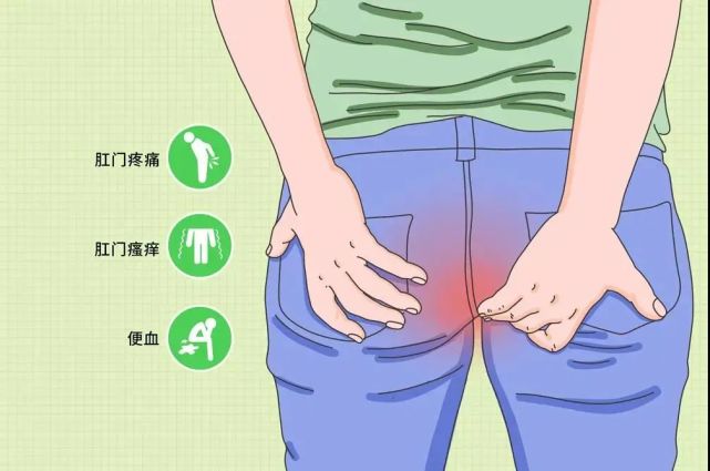 沈阳省医肛肠疾病研究所屁股出现这5种异常可能肛瘘要