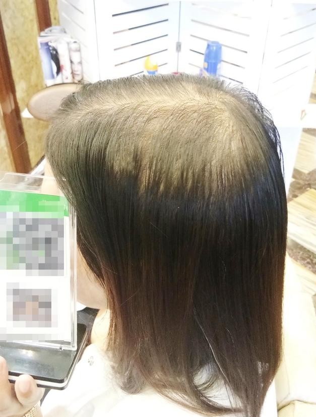 适合40岁遮白发的假发的清洗方法?
