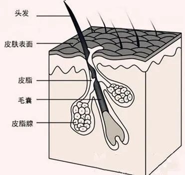 毛囊堵塞也会引起脱发吗?广州粤波医院