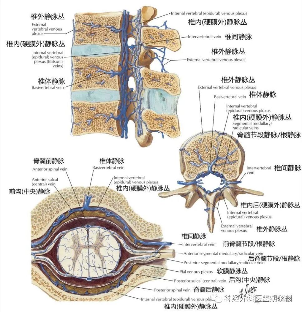 颈2神经根及其周围静脉丛的解剖关系