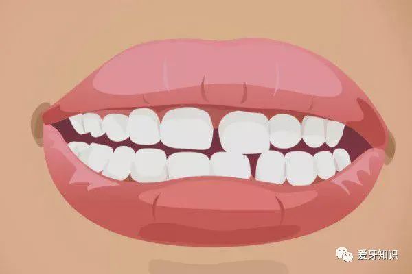 有没有感觉你的门牙牙缝变大了?
