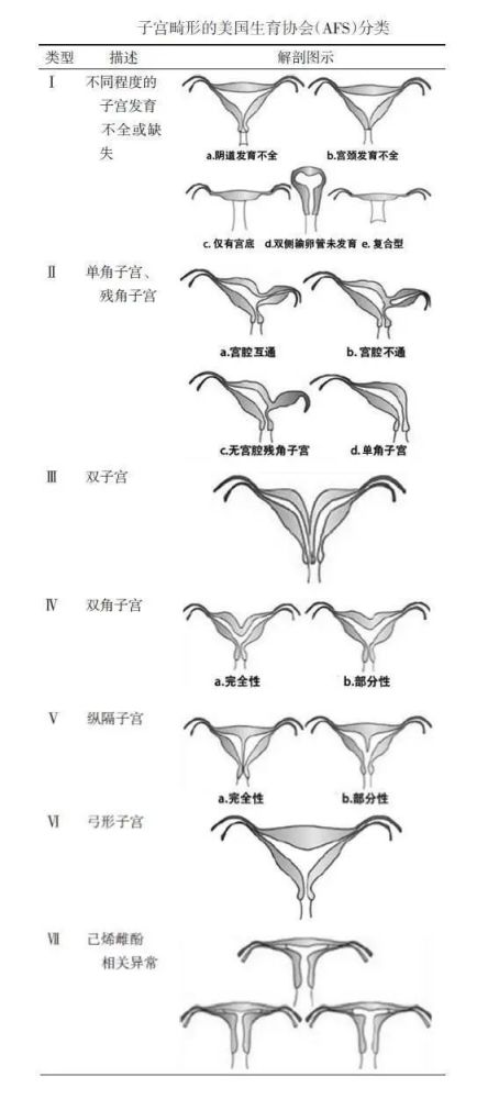 什么是双子宫?