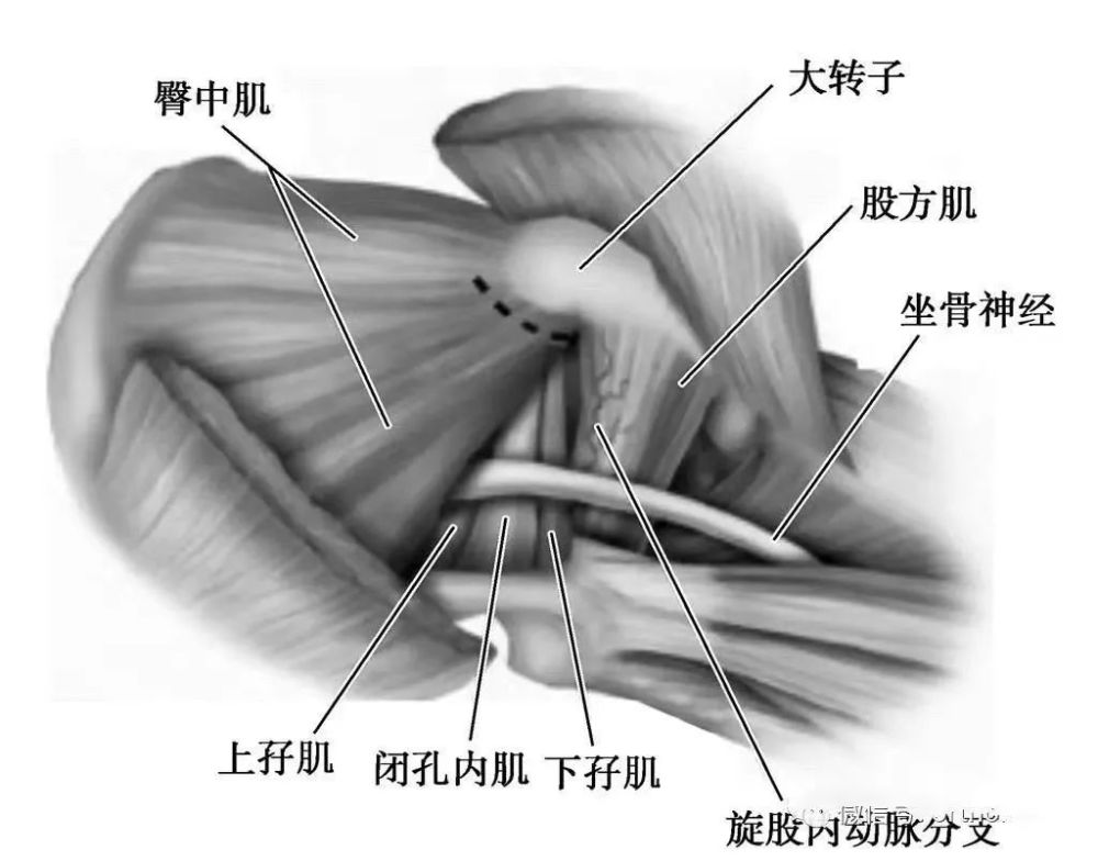 骨科精读|从髋关节的解剖到手术入路全过程,你要的解答全在这!