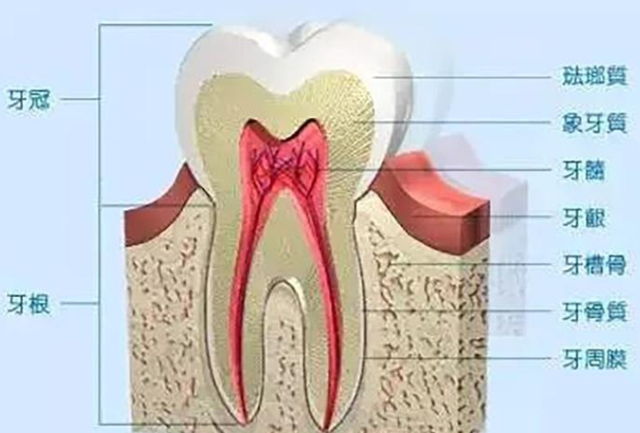 小心牙神经已坏死,看看你是吗?