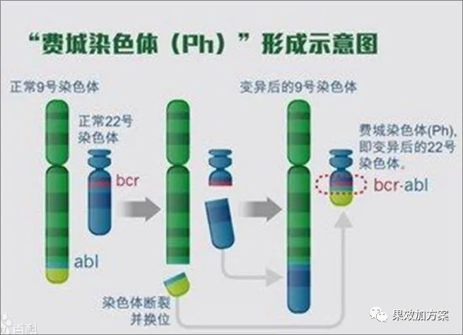 慢粒白血病与精准医疗