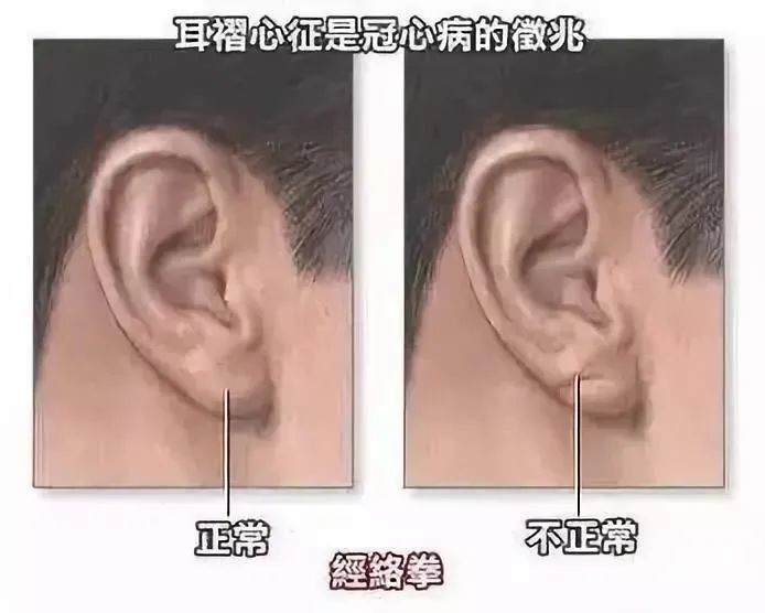 按摩耳朵居然有治牙疼奇效