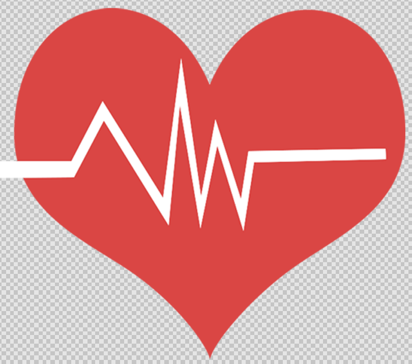 心搏骤停 是指患者心脏有效泵血功能突然丧失,导致血液循环停止,全身