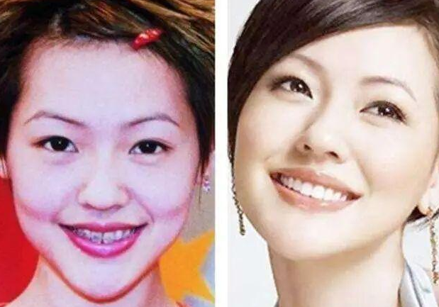 女明星出道前后差距大是整容还是整牙看完让你怀疑人生