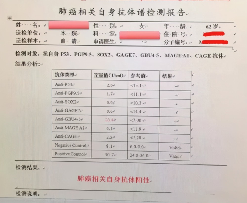 肺癌血清抗体七项检查有