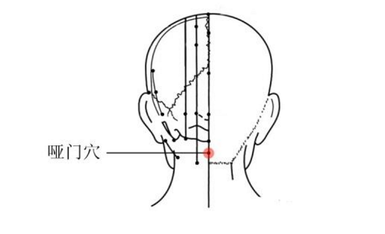 针灸常用腧穴——哑门