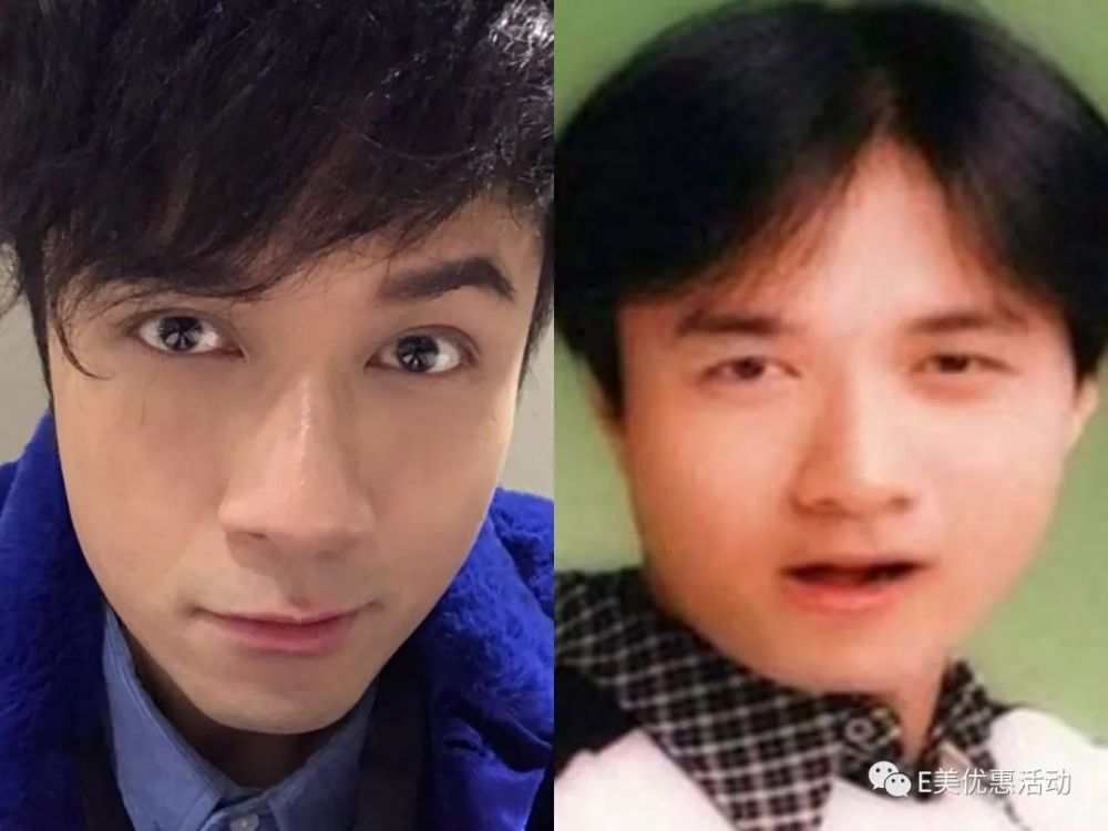 娱乐圈这么多男明星竟然都割过双眼皮成龙大哥陈学冬古巨基