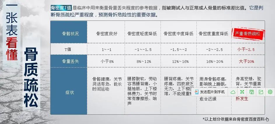 骨密度人人都需要查吗?