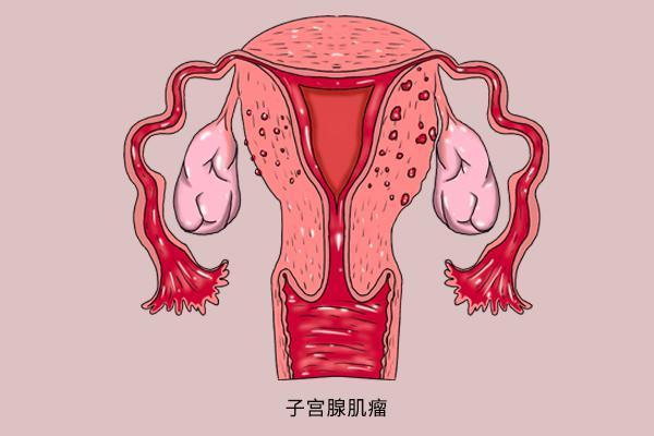 肿瘤医生公布难治愈的恶性肿瘤,全在肚子上,望能早做预防