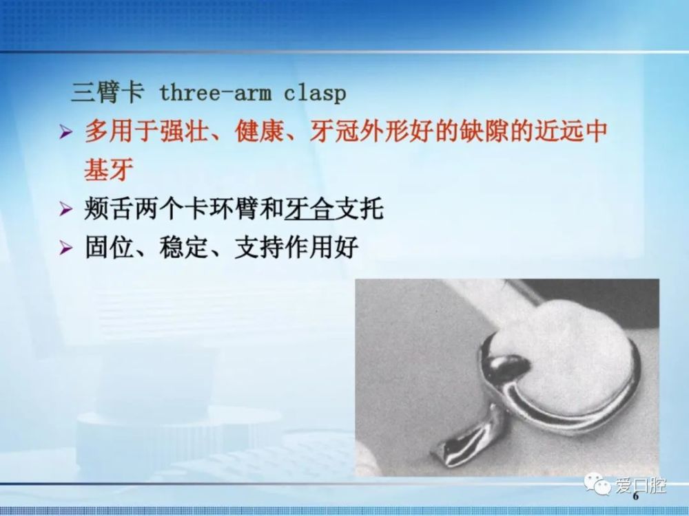 往期推荐 可摘局部义齿 可摘局部义齿的设计 弯制卡环的材料,原则及