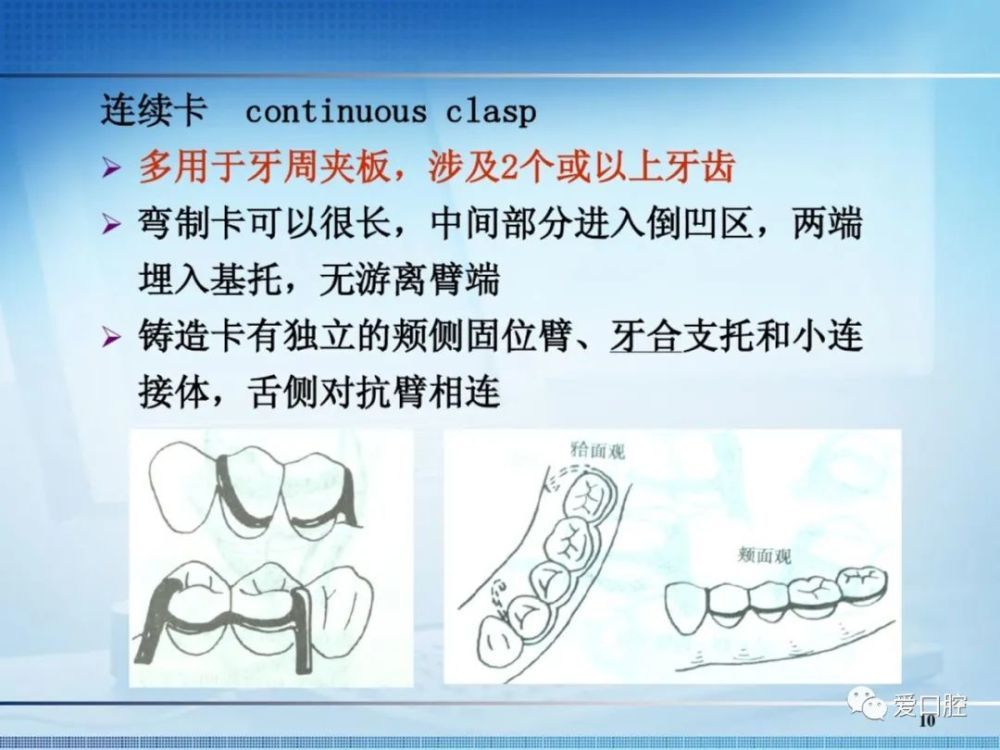 61 end 61往期推荐可摘局部义齿可摘局部义齿的设计弯制卡环的