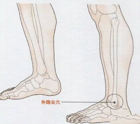 【按摩外踝尖穴位的作用】外踝尖穴属于经外奇穴,外踝尖穴的准确位置