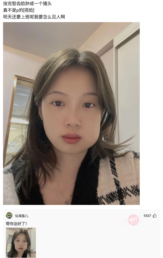 神回复:拔完智齿脸肿成一个猪头,真不是p的,明天还要上班呢,我要怎么