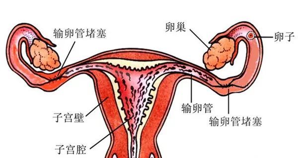 要切除吗?