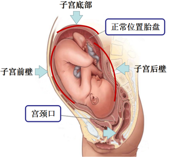 胎盘的正常位置,可位于宫腔的前壁,后壁,侧壁或宫底.01