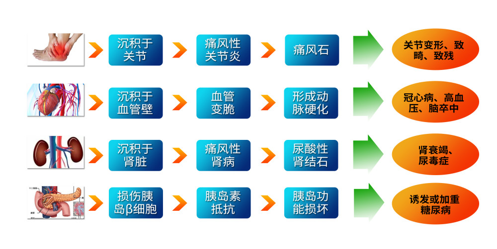 高尿酸并发症危及生命补充天然虾青素刻不容缓