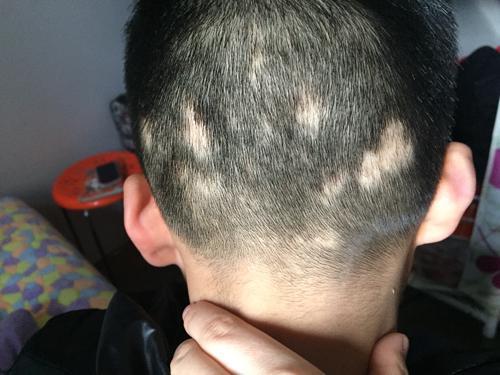 头上长虫的男孩?世界欠你们一个"小金