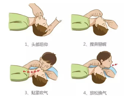 遇到呼吸心跳骤停的伤病员会进行心肺复苏