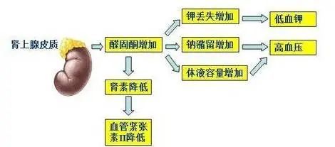 原发性醛固酮增多症的诊断应该没有问题,我给他用醛固酮拮抗剂螺内酯