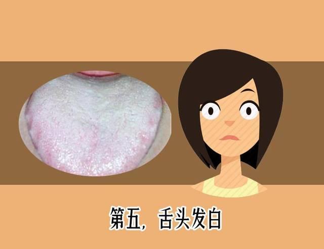胃里幽门螺杆菌滋生,嘴或会出现这些表现,平时多注意