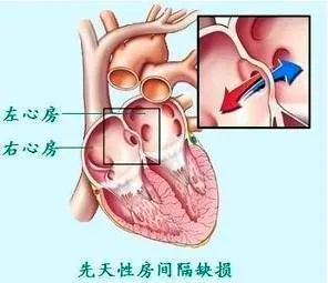 房由从其后上壁发出并向心内膜垫方向生长的原始房间隔分为左,右心房