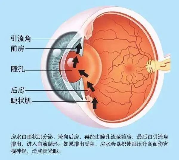 另外,在这个晶状体前移的过程中,因为前房变浅,房角关闭,即眼内房水