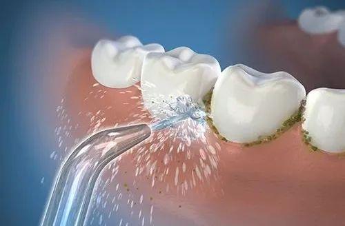 牙周炎和肾有关系预防和遏制牙周炎做好三点有帮助