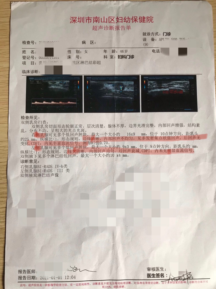 良恶性乳腺肿瘤b超报告对比图
