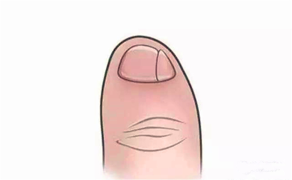 小脚趾甲裂成两瓣的人,到底什么来历?是纯种汉族人?
