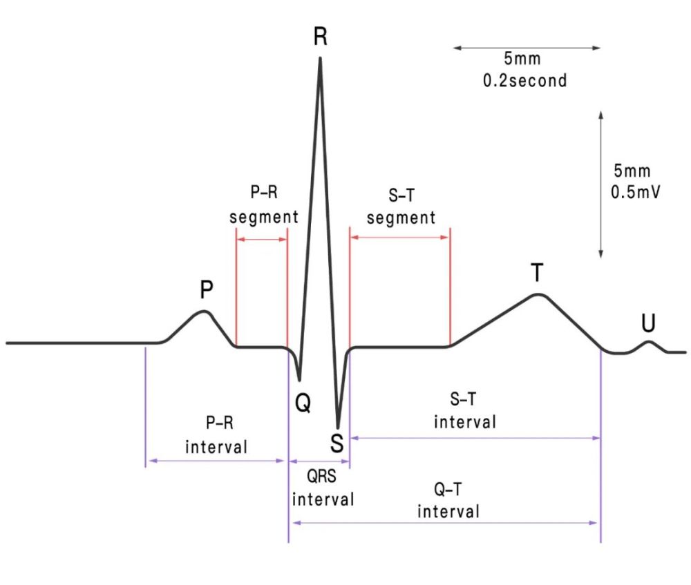 "一文教你读懂心电图