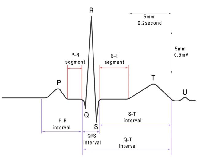 "窦性心律不齐就是心脏出问题了?"一文教你读懂心电图