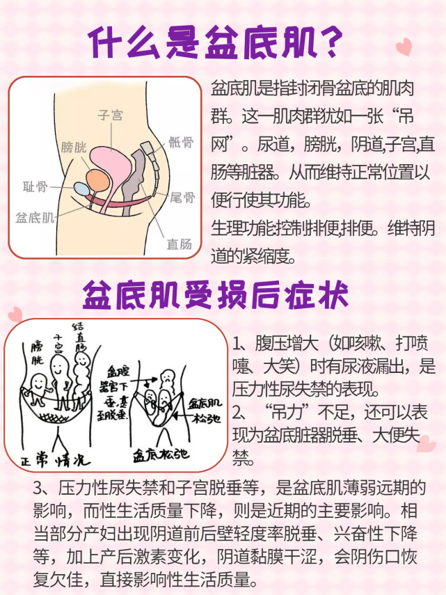 产后修复避坑指南!盆底|腹直肌|骨盆修复