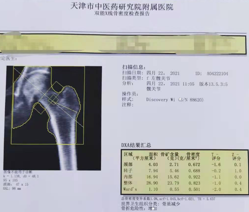 骨密度报告(腰椎)   骨密度报告(髋关节)