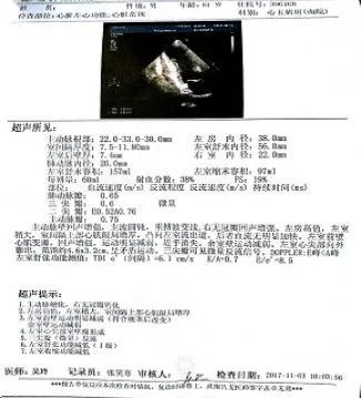 精彩病例丨cdqi名家面对面第三十三期:急性前壁心梗急诊pci术后合并