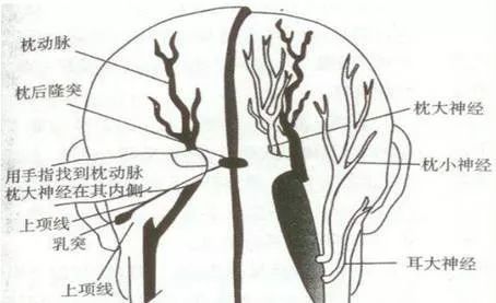 有一种头痛叫枕大神经痛你见过吗