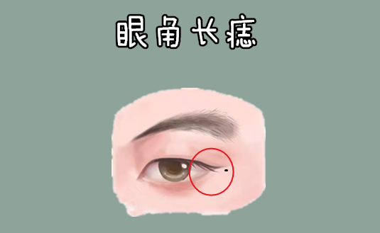 千金难买5颗痣命里藏黄金男人升官不愁女人发家不愁