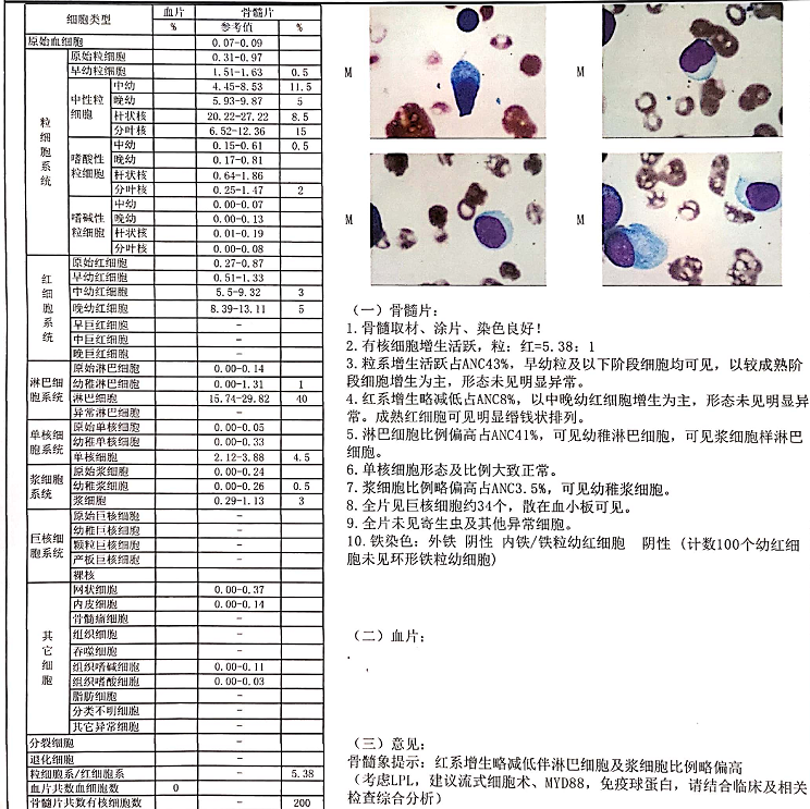 骨髓活检结果