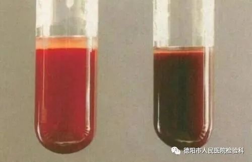 血液的7种颜色为什么你的血没有别人的红