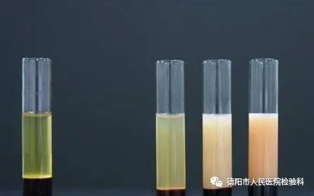 血液的7种颜色,为什么你的血没有别人的红|血红蛋白|乳糜血|动脉