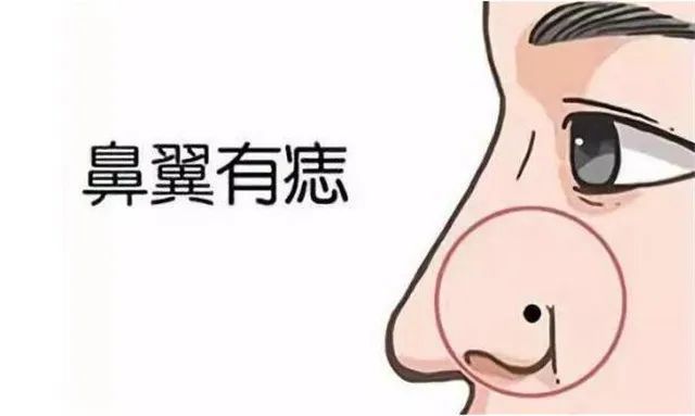 最有福气的10处痣相