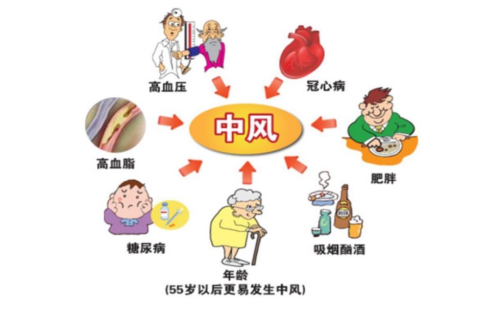 神经内科医生:脑梗发作前,身体早有前兆,最好不要无视