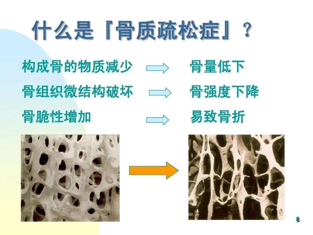 警惕骨质疏松