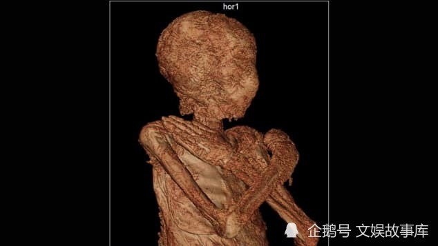 考古学家发现第一具怀孕的木乃伊
