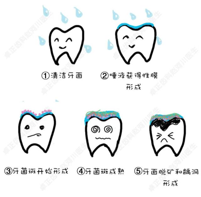 你牙上的细菌这么厚,难怪会蛀牙不断!_腾讯网