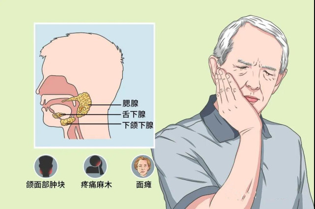 广药三院肿瘤一科丨腺性囊性癌是什么?