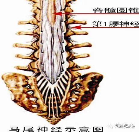 知道什么是脊髓马尾受累后,你决不会后悔